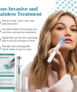 DIYSTAR™ LumeSkin Mole and Wart Removal Laser Pen
