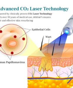 DIYSTAR™ LumeSkin Mole and Wart Removal Laser Pen