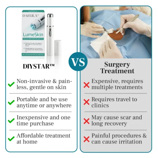 DIYSTAR™ LumeSkin Mole and Wart Removal Laser Pen