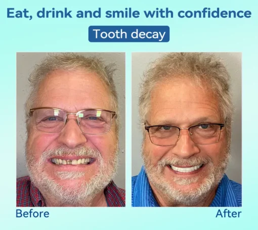 DIYSTAR™ 𝐏𝐫𝐞𝐦𝐢𝐮𝐦 𝐃𝐞𝐧𝐭𝐮𝐫𝐞