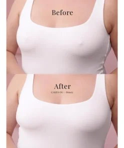 DIYSTAR circles - The 1st viral non-adhesive nip cover