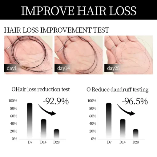 SUMMER Sale Countdown! DIYSTAR™ Root Activator Shampoo