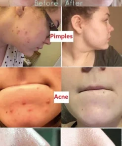 Diystar™ 100% Natural Green Tea Deep Cleanse Mask